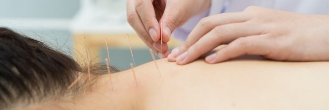 acupuncture