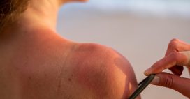 L’antisunscreen : n’abandonnez pas la crème solaire !